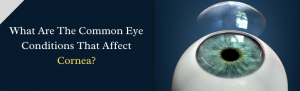 Read more about the article What Are The Common Eye Conditions That Affect Cornea?