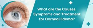 What are the Causes, Symptoms, and Treatment for Corneal Edema (Swelling)?