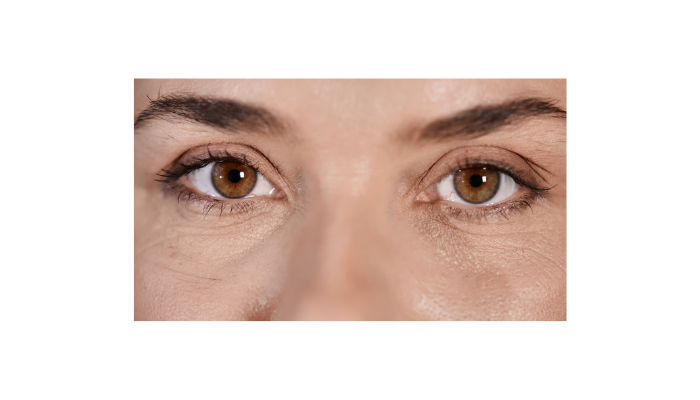 Recovery After Collagen Cross-Linking (Cxl) Eye Surgery