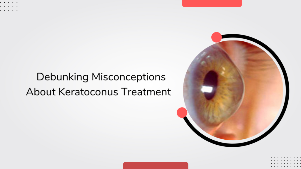 Debunking Misconceptions About Keratoconus Treatment