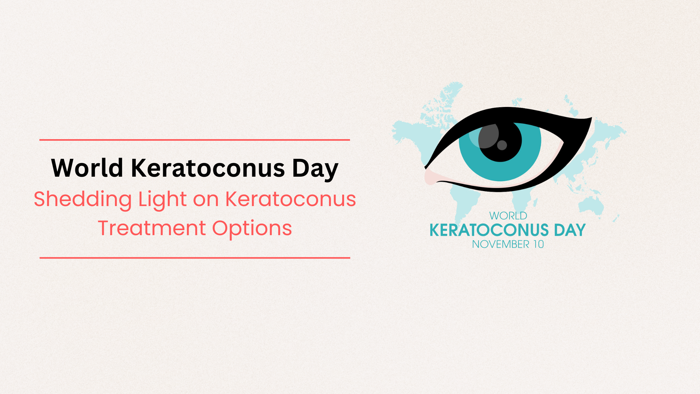 Read more about the article World Keratoconus Day: Shedding Light on Keratoconus Treatment Options