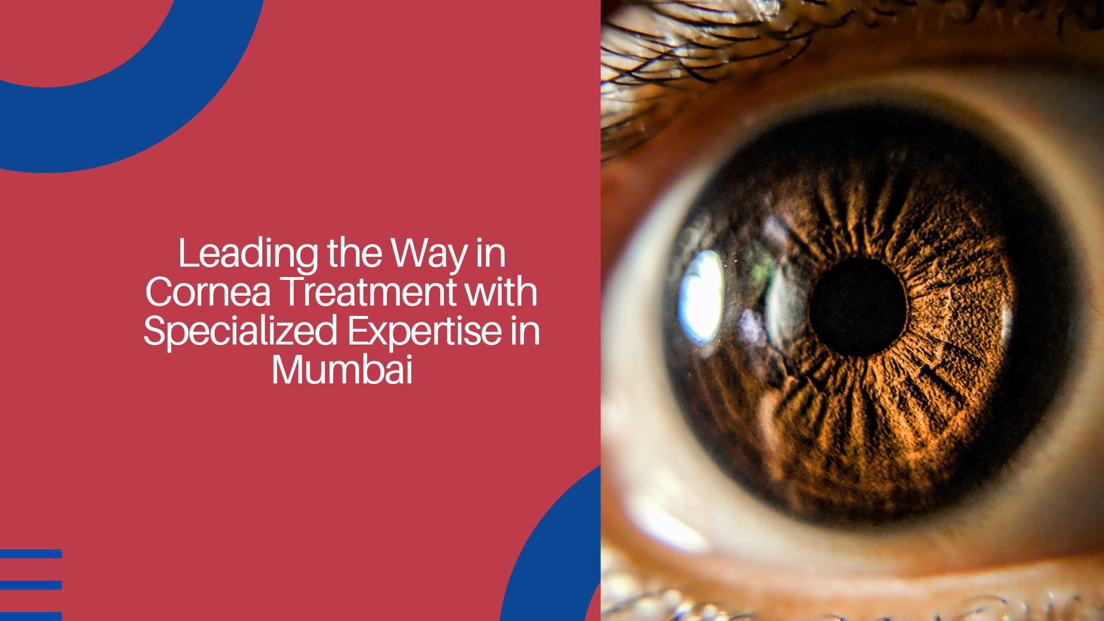 Read more about the article Leading the Way in Cornea Treatment with Specialized Expertise in Mumbai
