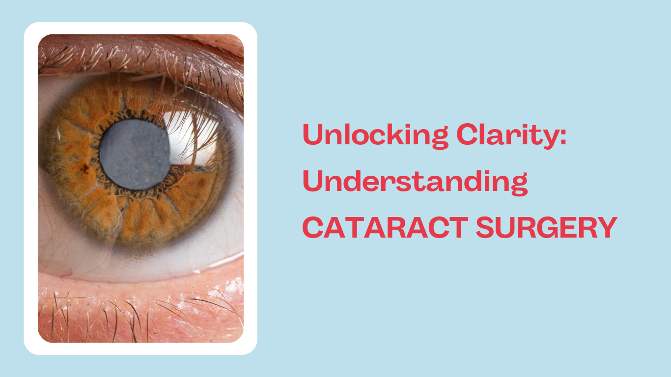 Read more about the article Unlocking Clarity: Understanding CATARACT SURGERY IN MUMBAI