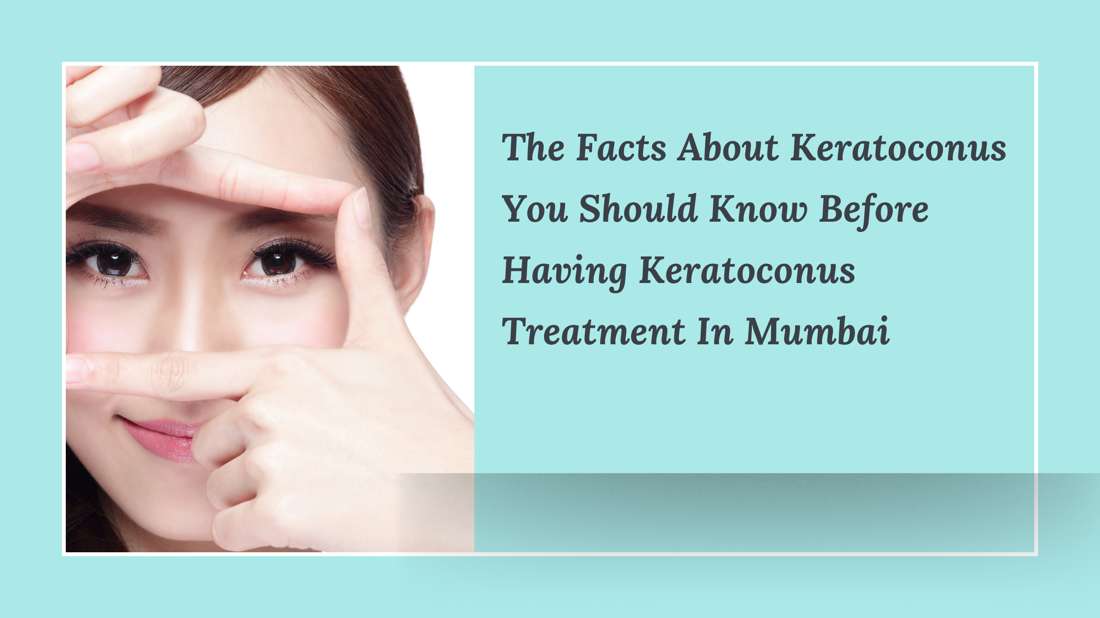 Read more about the article  The Facts About Keratoconus You Should Know Before Having Keratoconus Treatment In Mumbai