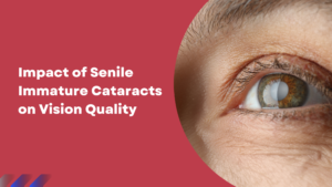 Read more about the article Impact of Senile Immature Cataracts on Vision Quality