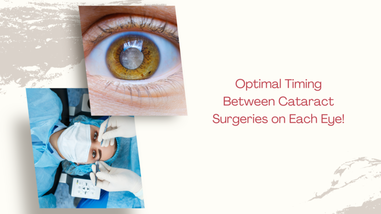 Optimal Timing Between Cataract Surgeries on Each Eye