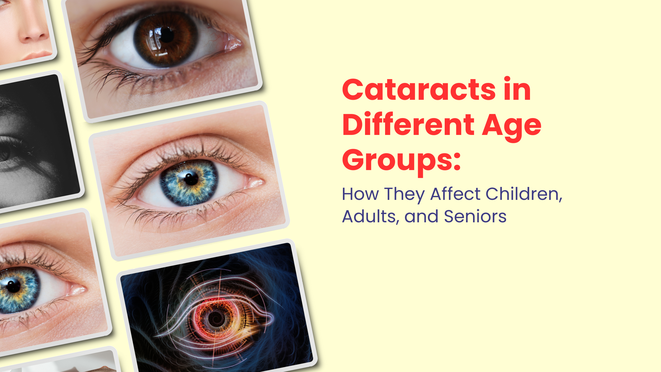 Read more about the article Cataracts in Different Age Groups: How They Affect Children, Adults, and Seniors