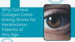 Read more about the article Why Corneal Collagen Cross-linking Works for Keratoconus Patients of Any Age