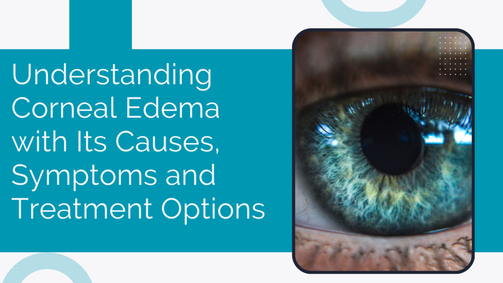 Understanding Corneal Edema with Its Causes, Symptoms and Treatment Options