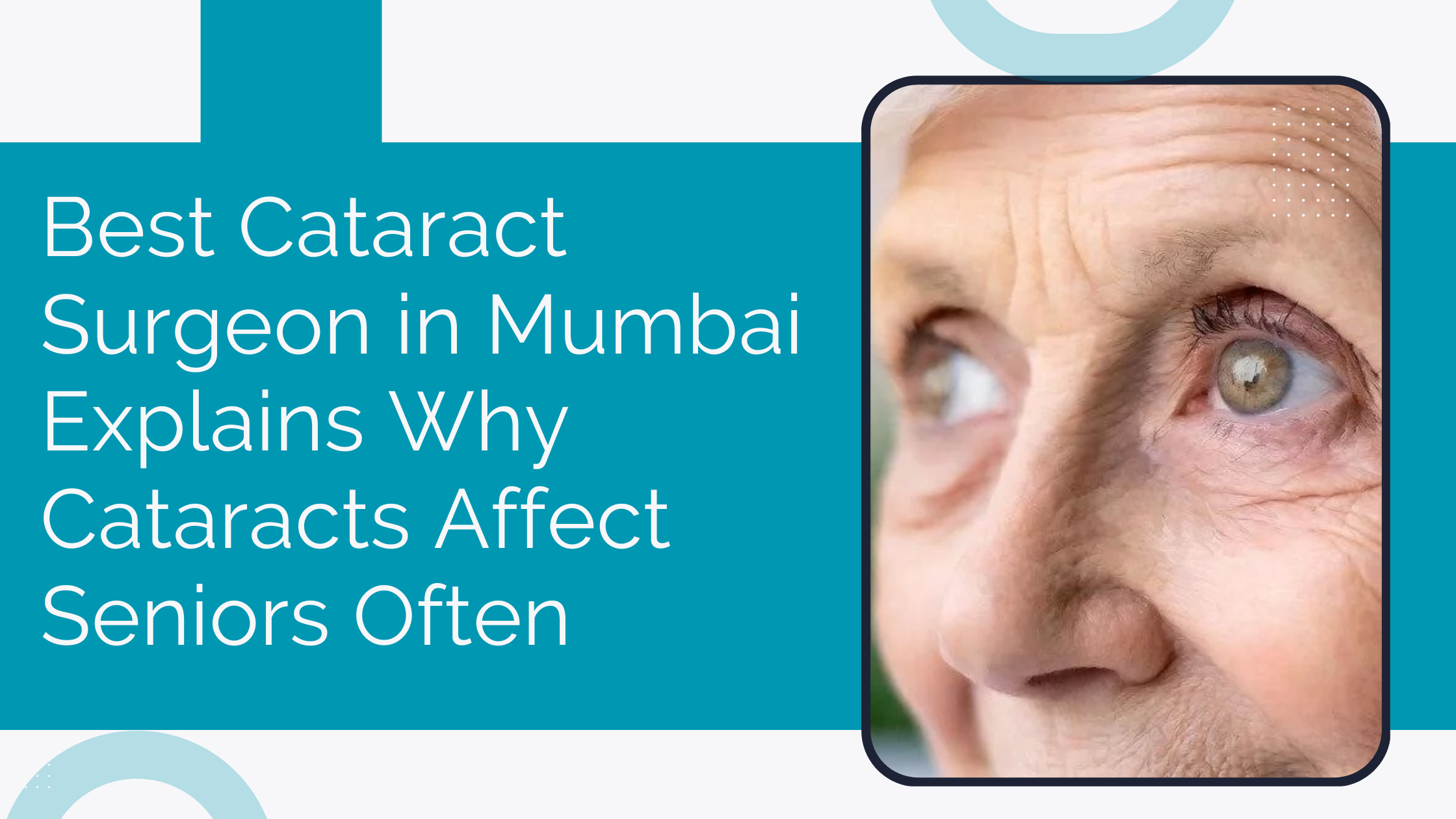 You are currently viewing Best Cataract Surgeon in Mumbai Explains Why Cataracts Affect Seniors Often