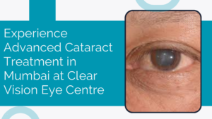 Read more about the article Experience Advanced Cataract Treatment in Mumbai at Clear Vision Eye Centre