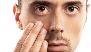 dry eye condition of eyes