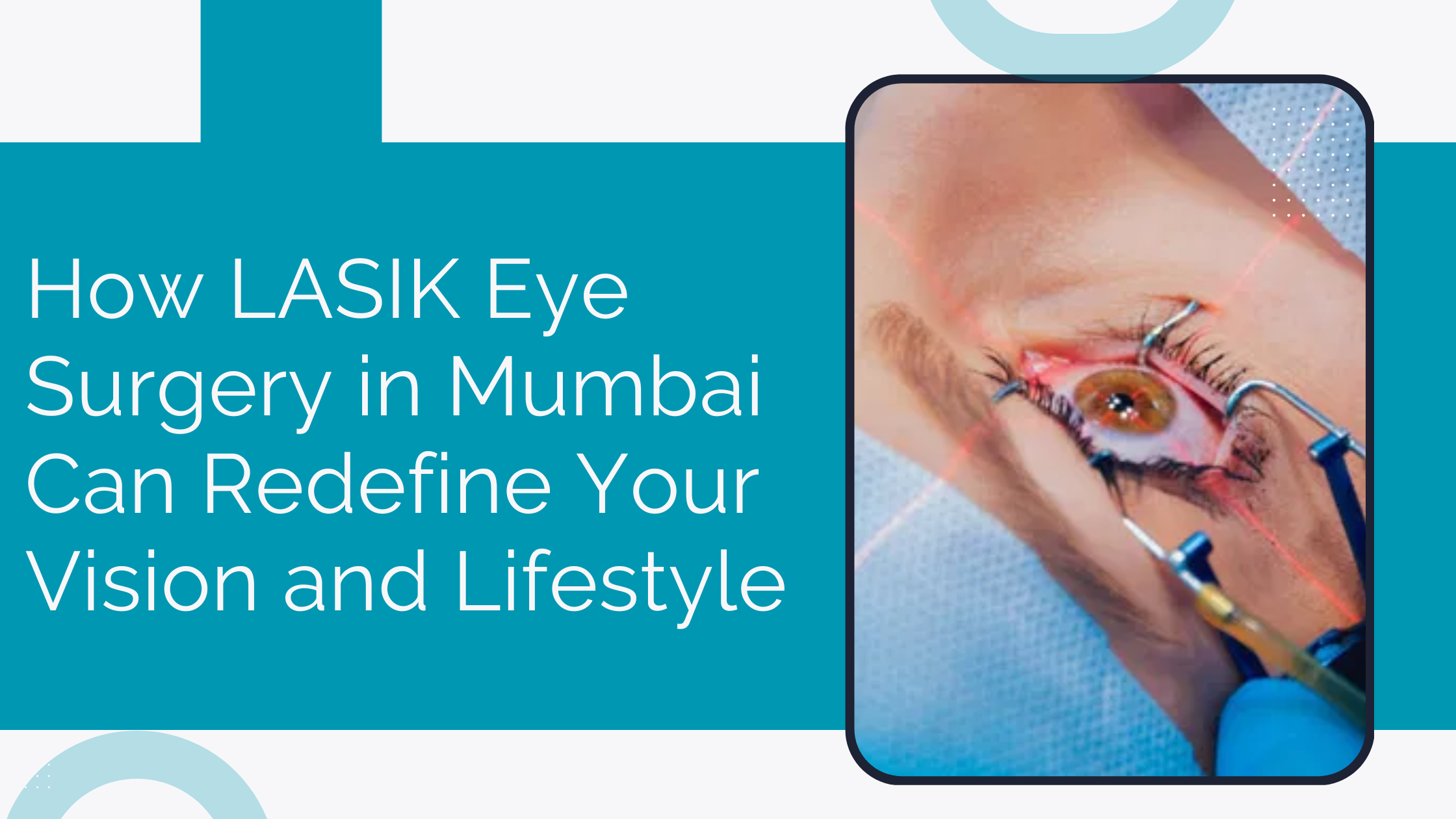 How LASIK Eye Surgery in Mumbai Can Redefine Your Vision and Lifestyle