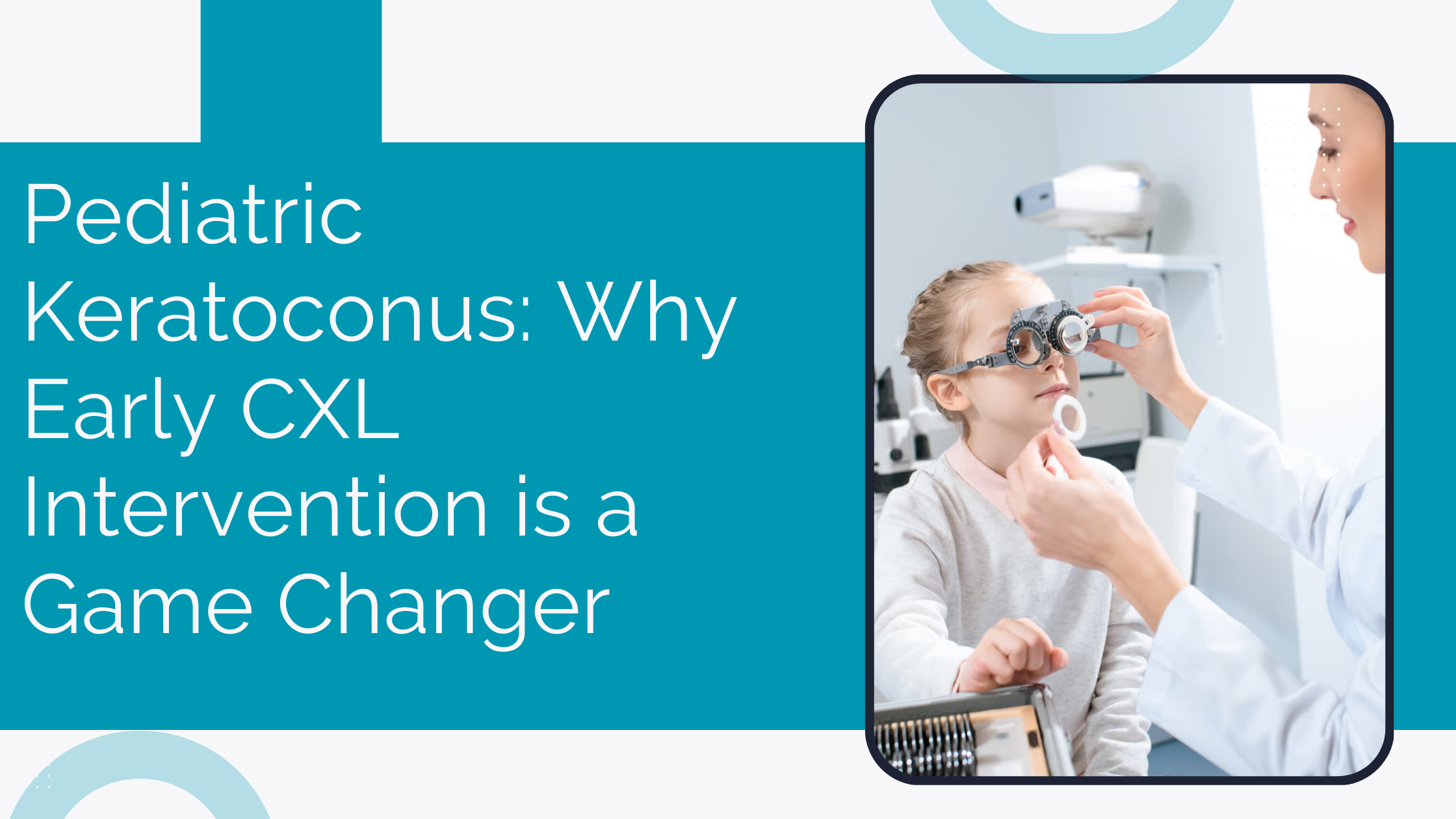 Pediatric Keratoconus Why Early Cxl Intervention Is A Game Changer