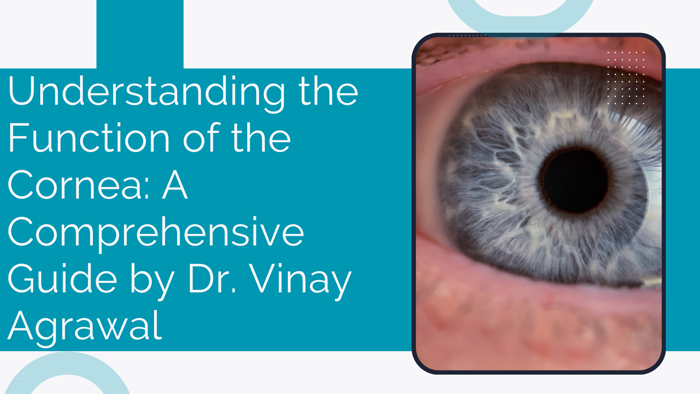 Understanding the Function of the Cornea A Comprehensive Guide by Dr. Vinay Agrawal