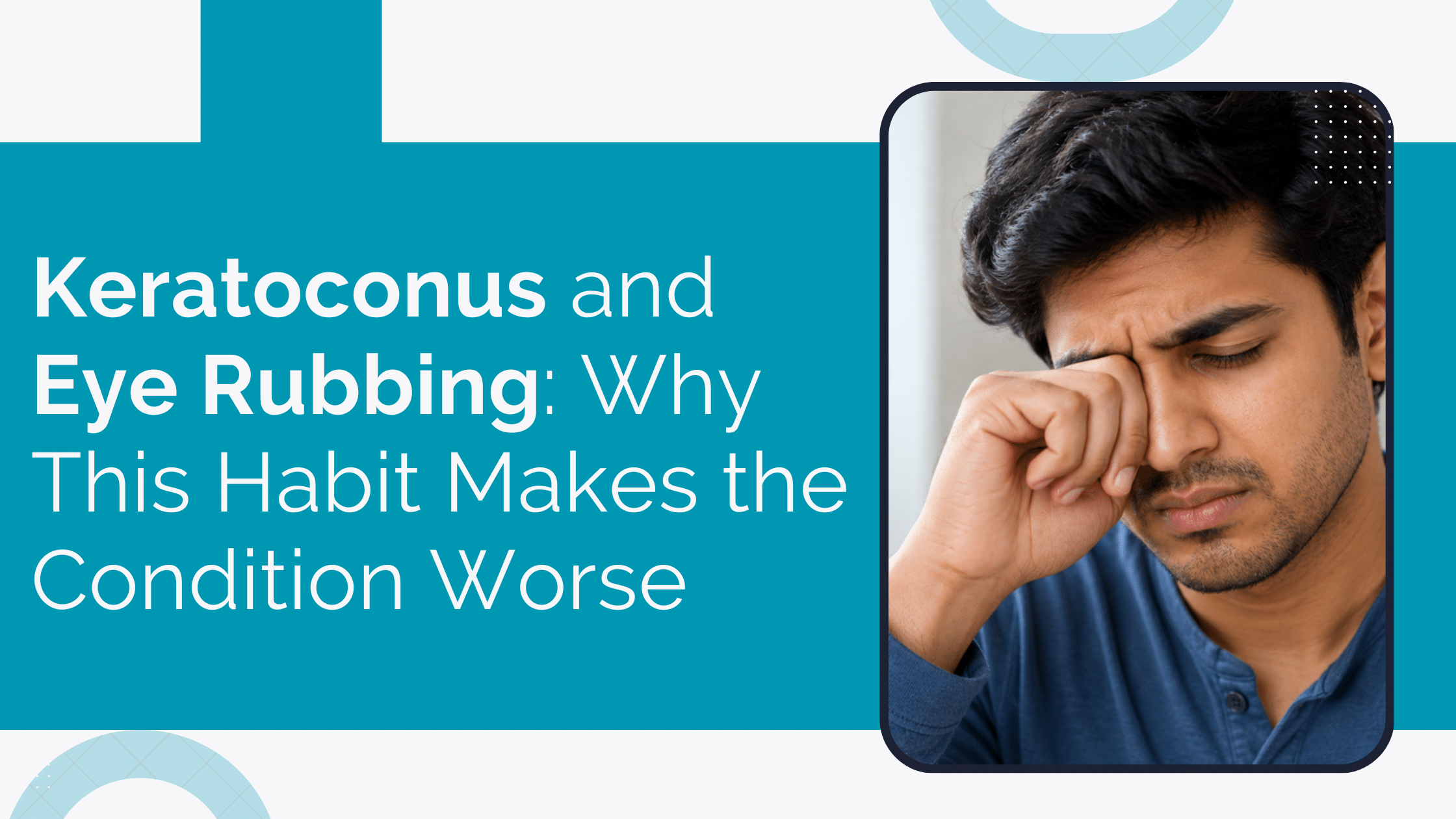 Home 13 Keratoconus And Eye Rubbing: Why This Habit Makes The Condition Worse