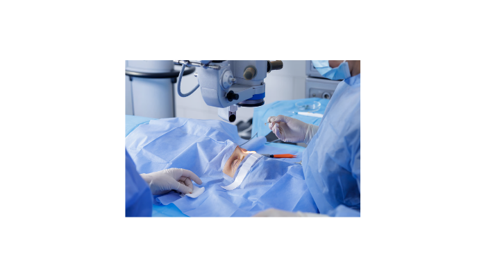 Customized Surgical Planning for Advanced Cataracts