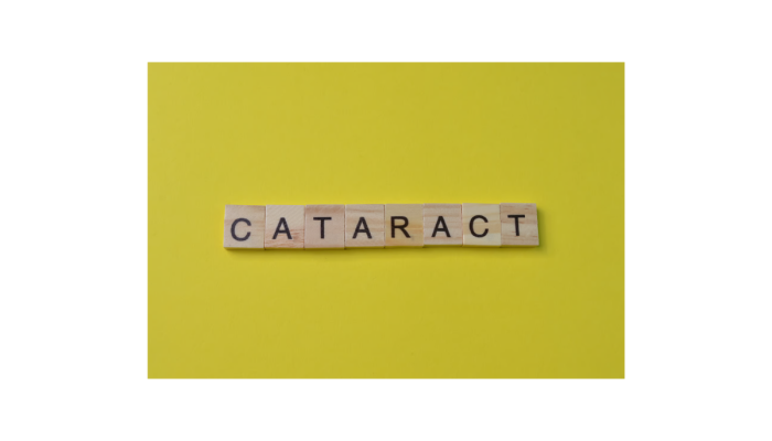 What Determines the Cataract Surgery Cost